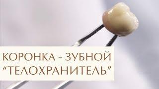  Зачем и когда нужно ставить коронку на зуб: ответ стоматолога. Зачем ставить коронку на зуб. 12+