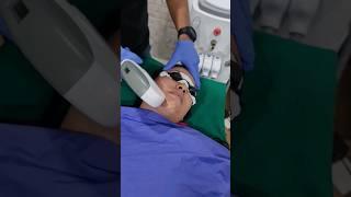 UPPER LIP, JAW LINE & CHIN permanent hair removal @vrindavan hospital #skin #hair #trending #viral