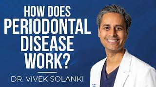 Modern Day Smiles: Dr. Vivek Solanki, DDS - How Does Periodontal Disease Work In a Nutshell?