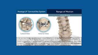 Cervical Disc Arthroplasty