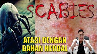 SCABIES..................... ATASI DENGAN MENGGUNAKAN BAHAN HERBAL