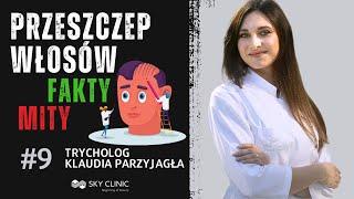 Fakty i mity o transplantacji włosów | Wywiad z Trychologiem Klaudią Parzyjagłą | Sky Clinic