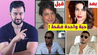 كشف المستور .. سر بياض بشرة المشاهير