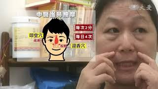 按摩穴道針灸治療 減緩過敏性鼻炎症狀