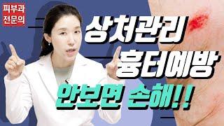 (*Eng) 흉터 안남는 상처관리법 핵심(여드름흉터, 넘어진상처, 화상물집, 베인상처) - 피부과전문의 [닥터필러]