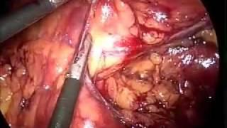 VA Operation