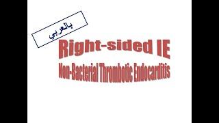 5. Right-sided IE & NBTE (Arabic Version)