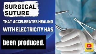 Surgical suture that accelerates healing with electricity has been produced.