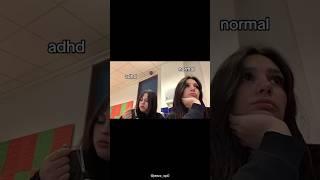 ADHD vs NORMAL