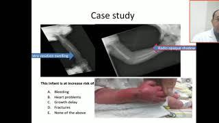 Case 58  soft tissue swelling due calcium extravasation,