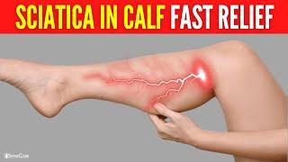 How to Instantly Relieve Sciatica Pain in the Calf