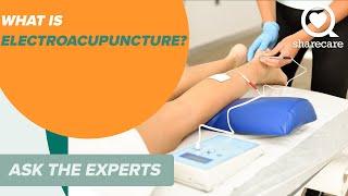 What is Electroacupuncture? | Ask The Experts | Sharecare