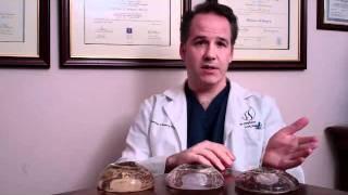 Do Breast Implants Come in Different Shapes? | Ask Dr. Sterry