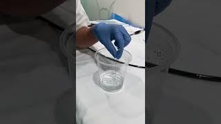 ElectroHydrolaulic Lithotripsy EHL in slow motion   HD 720p