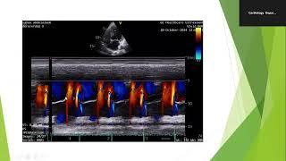 Echo Conference 6-11-2024 (Assessment of LV Diastolic Function)