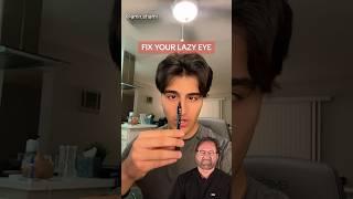 FIX YOUR LAZY EYE Surgeon Reacts