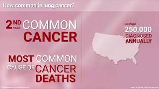 Understanding Small Cell Lung Cancer