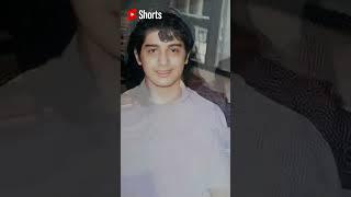 IAN VENERACION BEFORE AND AFTER #shorts #beforeandafter #showbiz