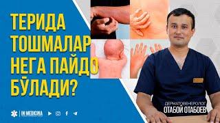 Терида Тошмалар Нега Пайдо Бўлади? #inmedicina  #toshmalar #alergia