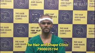 Hair transplant Patient Review -  4