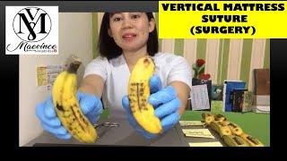 MEDICINE VLOG #15: SURGERY (VERTICAL MATTRESS SUTURE)