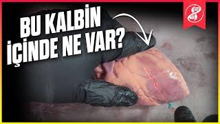 Kalbin İçinde Ne Var? Açıp Bakalım!