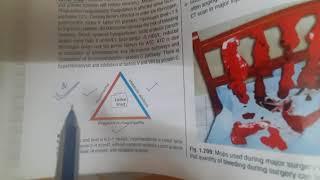 Hemorrhage....General Surgery