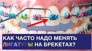 Как часто надо менять лигатуры на брекетах?