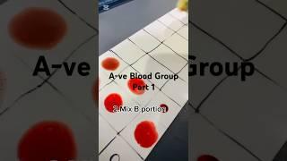 A-ve Part 1 how to easy and simple method #bloodgroup @Lablearning10 @Pathalogy10 #laboratory