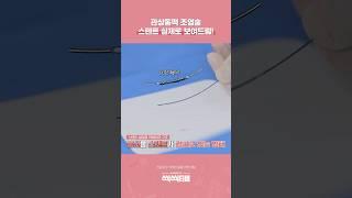 관상동맥 조영술(CAG), 스텐트 실제로 보여드림! #관상동맥 질환 #조정래 교수