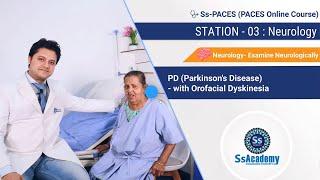 PACES 2023 New Format | PD( Parkinson's Disease )-With Orofacial Dyskinesia | Station-03 : Neurology