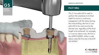 IT9+0:00 / 1:25C-TECH Guided Surgery: Surgical protocol