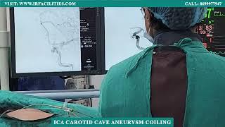 ICA Carotid Cave Aneurysm Coiling: Revolutionary Procedure by Dr. Sandeep Sharma | IRFACILITIES