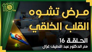 صحتك أولاً 16 - مرض تشوه القلب الخلقي | الدكتور عبد اللطيف غزال