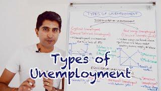 Y1 21) Types and Causes of Unemployment (Cyclical, Structural, Frictional and more)