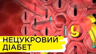 Нецукровий діабет | Рубрика "Запитай у лікаря"