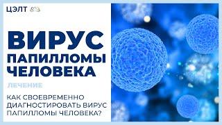 Вирус папилломы человека лечение.  Как своевременно  диагностировать вирус папилломы человека?