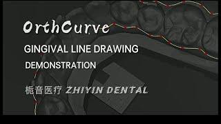 OrthCurve Demonstration