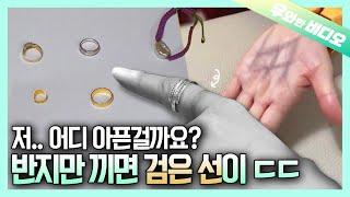 미스터리️ 반지만 끼면 생기는 검은 선의 비밀┃The Secret of a Black Line which Appears when Wearing a Ring ️