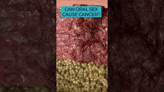 Understanding the Connection Between Oral Sex, HPV, and Cancer ️ #oralcancer #HPV