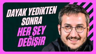 Bel Altı Espri Yapma Hastalığı | Feyyaz Yiğit İle Dert Dinleme Servisi