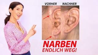 Narben, Pigmentstörungen, Haarausfall unsichtbar machen - Effektive Methode I DoktorJulie