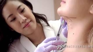 Dr Grace Peng Kybella injections