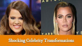 Top 10 Shocking Celebrity Transformations | exclusive top 10