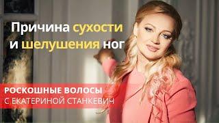 Причина сухости и шелушения ног