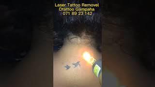 #srilanka #tattoo #gampaha #remove #tattooremove #laser #tattooremover #tattooshop #tattooshop