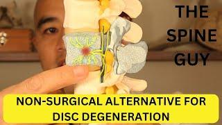 What is Basivertebral Nerve Ablation? A non-surgical alternative for Degenerative Disc Disease