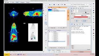 S1E7 Image processing and VOI analysis