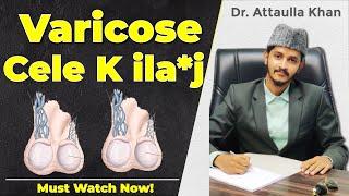 4th stage varicose cele kaise the*ek ho sa*kthe hai? Dr. Attaullah Khan