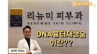 DNA진피재생술(흉터치료)